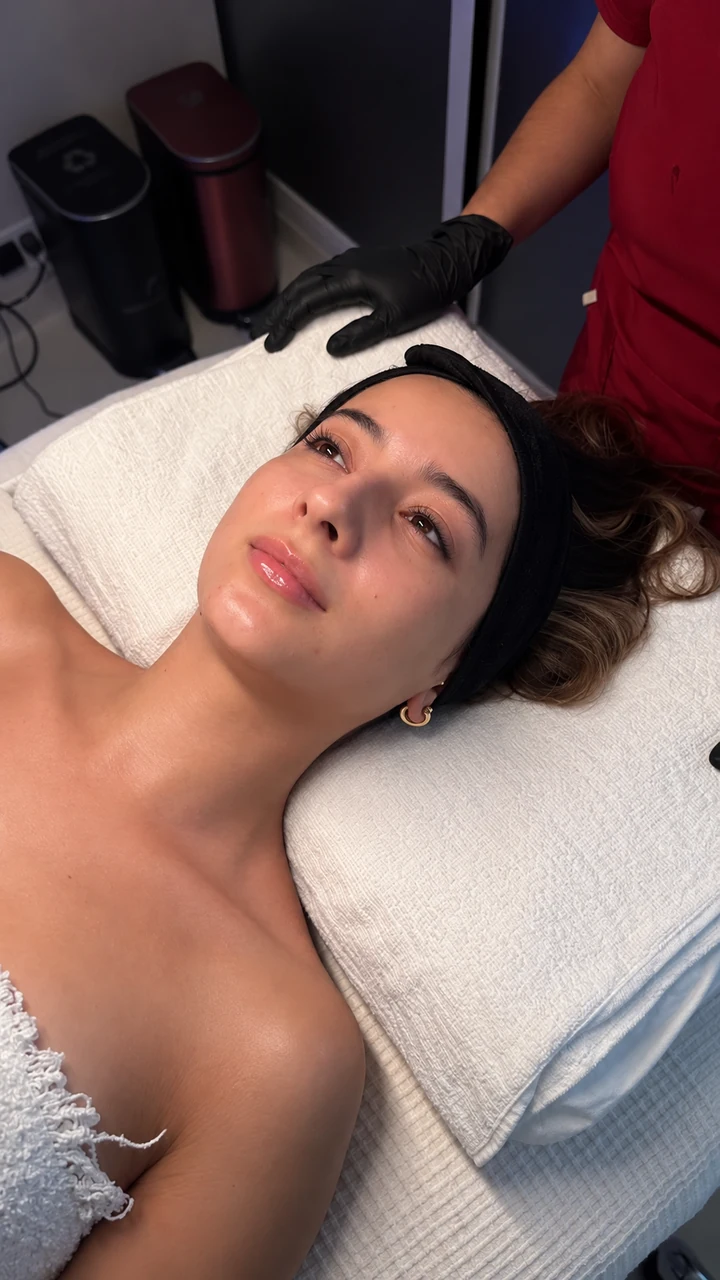 Fotografía 01 compartida como después de una sesión de Hydrafacial