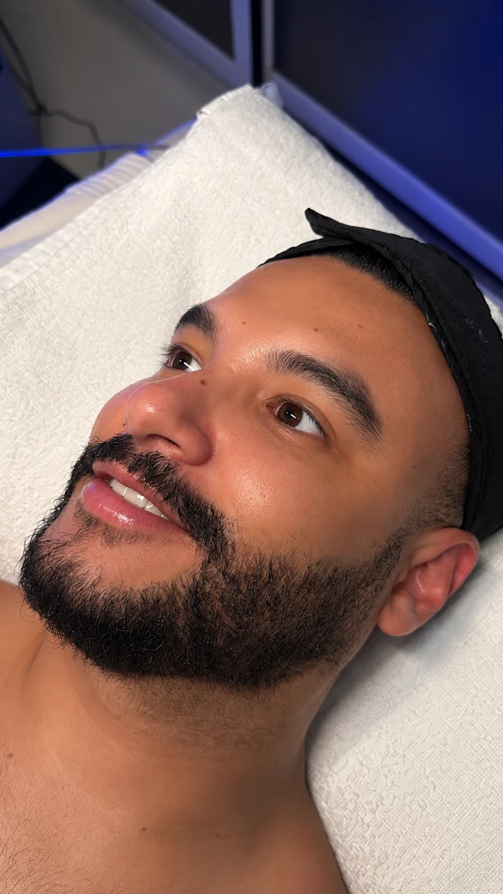 Fotografía 05 compartida como después de una sesión de Hydrafacial